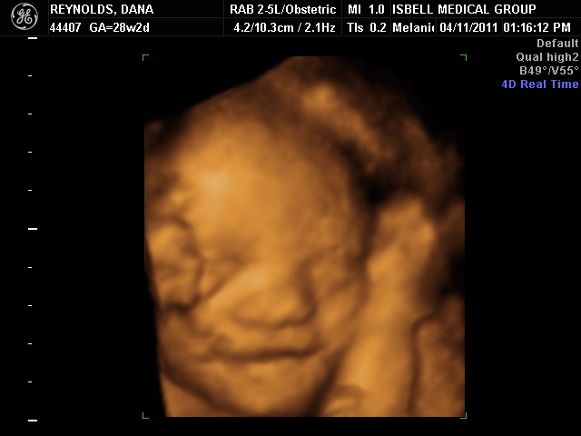 BABY GIRL 4D PICS_23