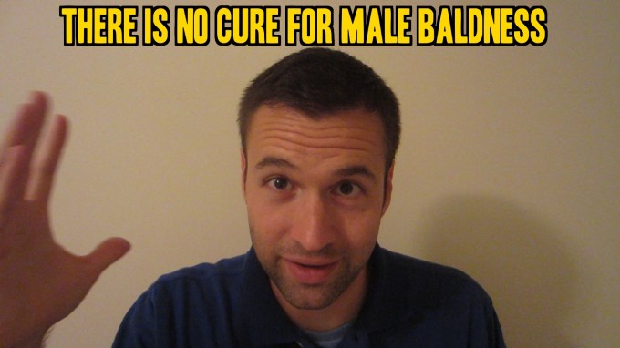 There is No Cure for Male Baldness or a Receding Hairline