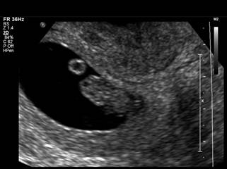 Dear Holly or Logan: You’re Due on April 21, 2016