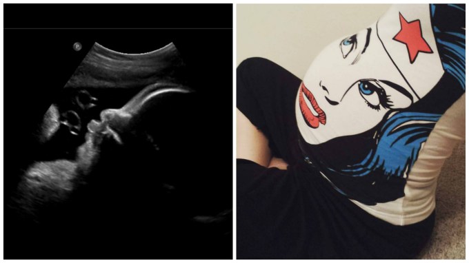 Dear Holly: You’re Going to Be a Small Baby; in the 23rd Percentile