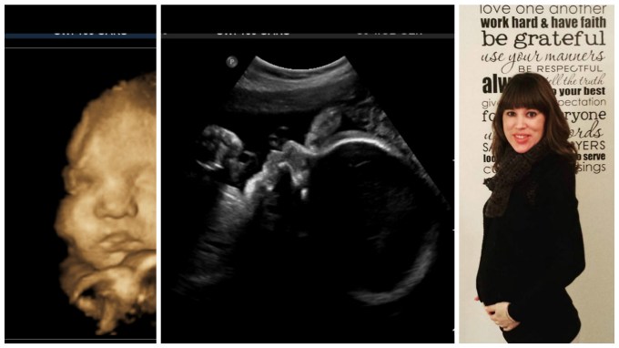 Dear Holly: Your Newest Sonogram Pictures