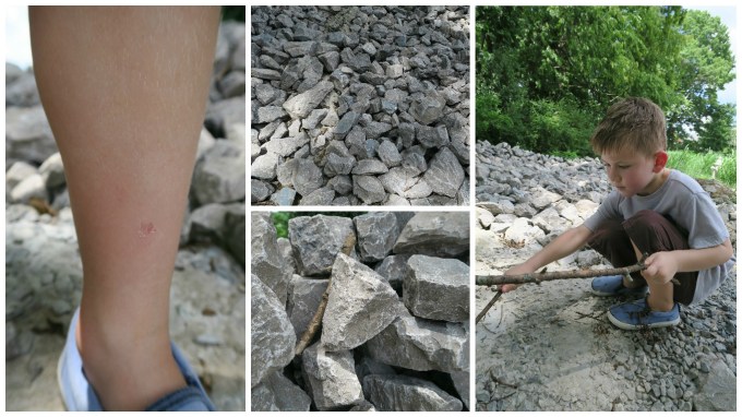 Dear Jack: Sticks and Stones May Break Other Sticks and Stones (and Skin Your Leg)